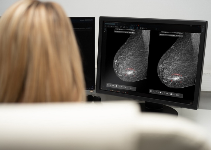 В Москве нейросеть по ОМС обработала более 350 тыс. маммограмм за год
