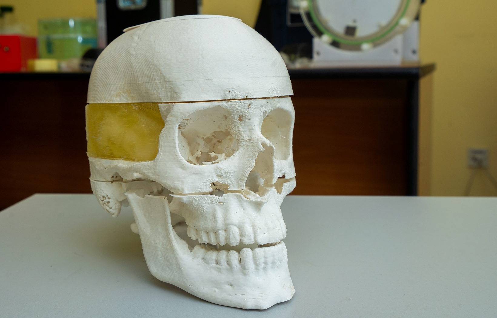 Фантом для исследования сосудов через кости черепа с использованием средств ультразвуковой визуализации, фото 3