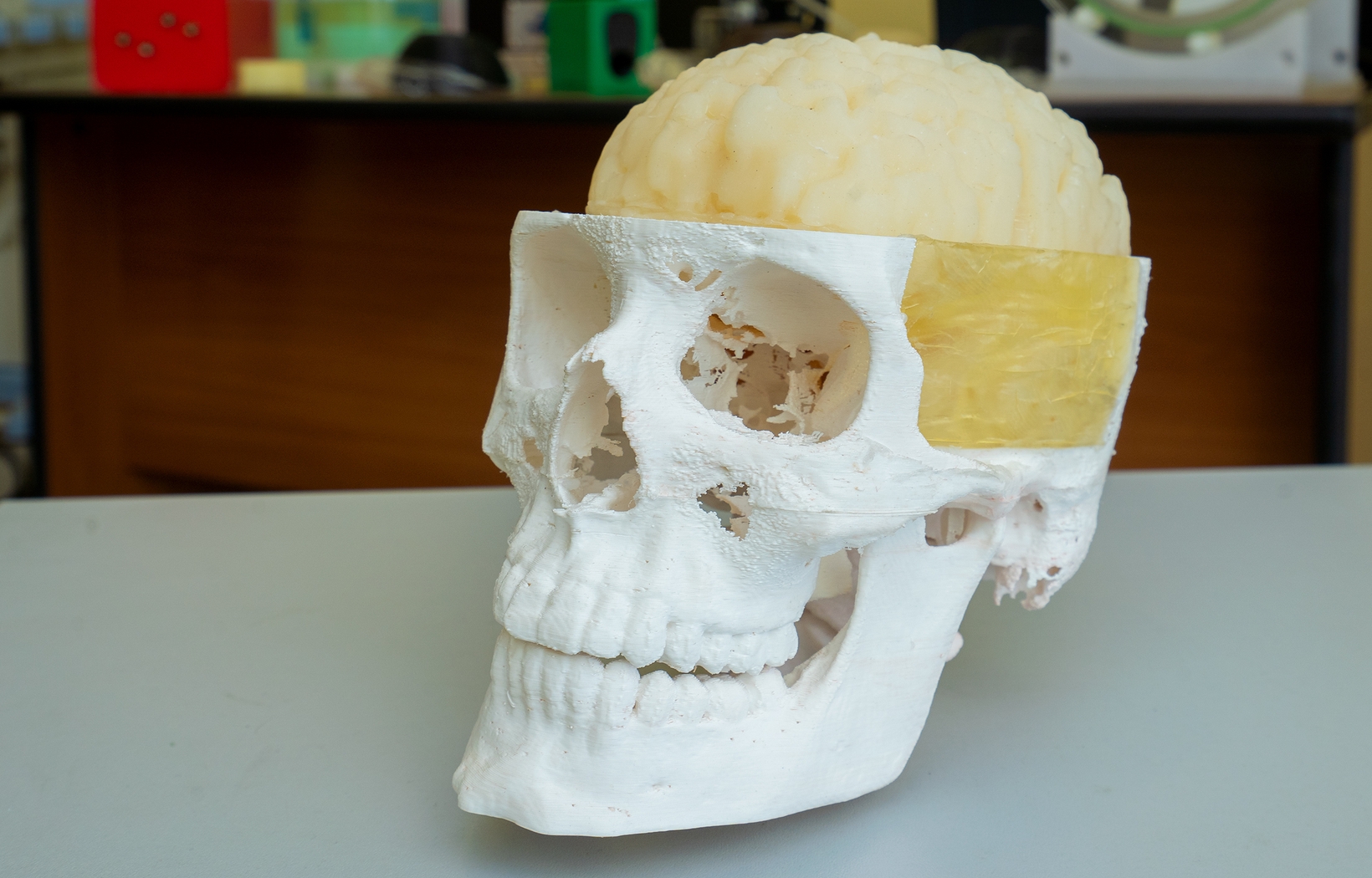 Фантом для исследования сосудов через кости черепа с использованием средств ультразвуковой визуализации, фото 4