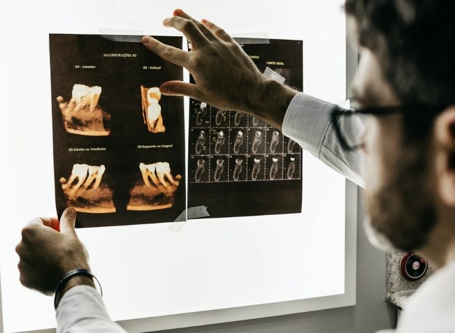 У рентгенологов появилась система дистанционного обучения