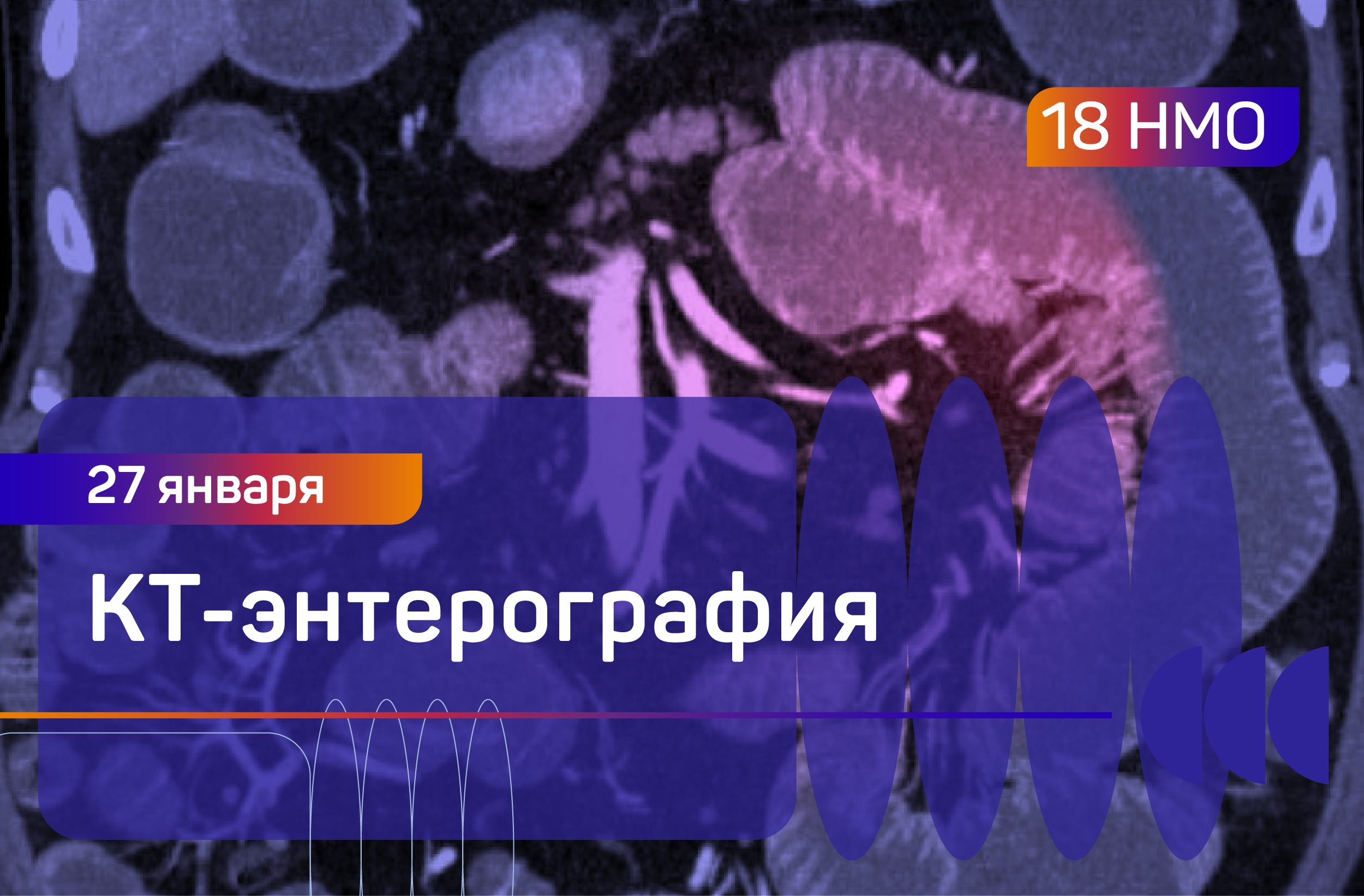 КТ-энтерография