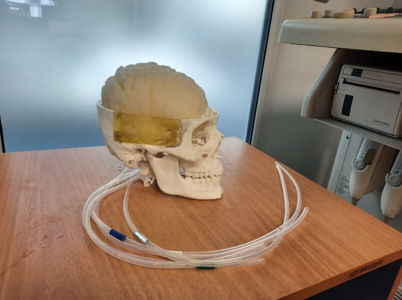 Фантом для исследования сосудов через кости черепа с использованием средств ультразвуковой визуализации, фото 7