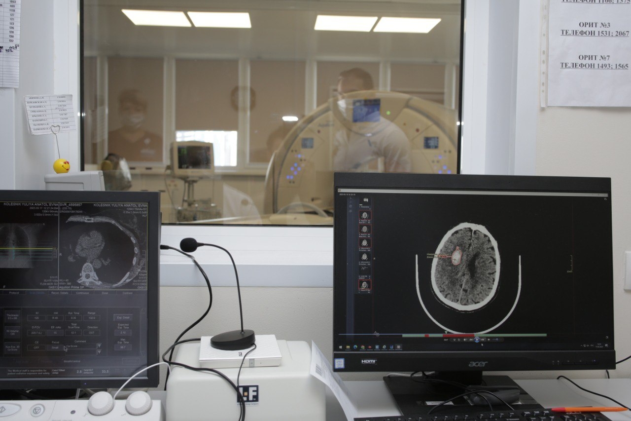 В Москве искусственный интеллект теперь помогает находить ишемический инсульт на КТ головного мозга