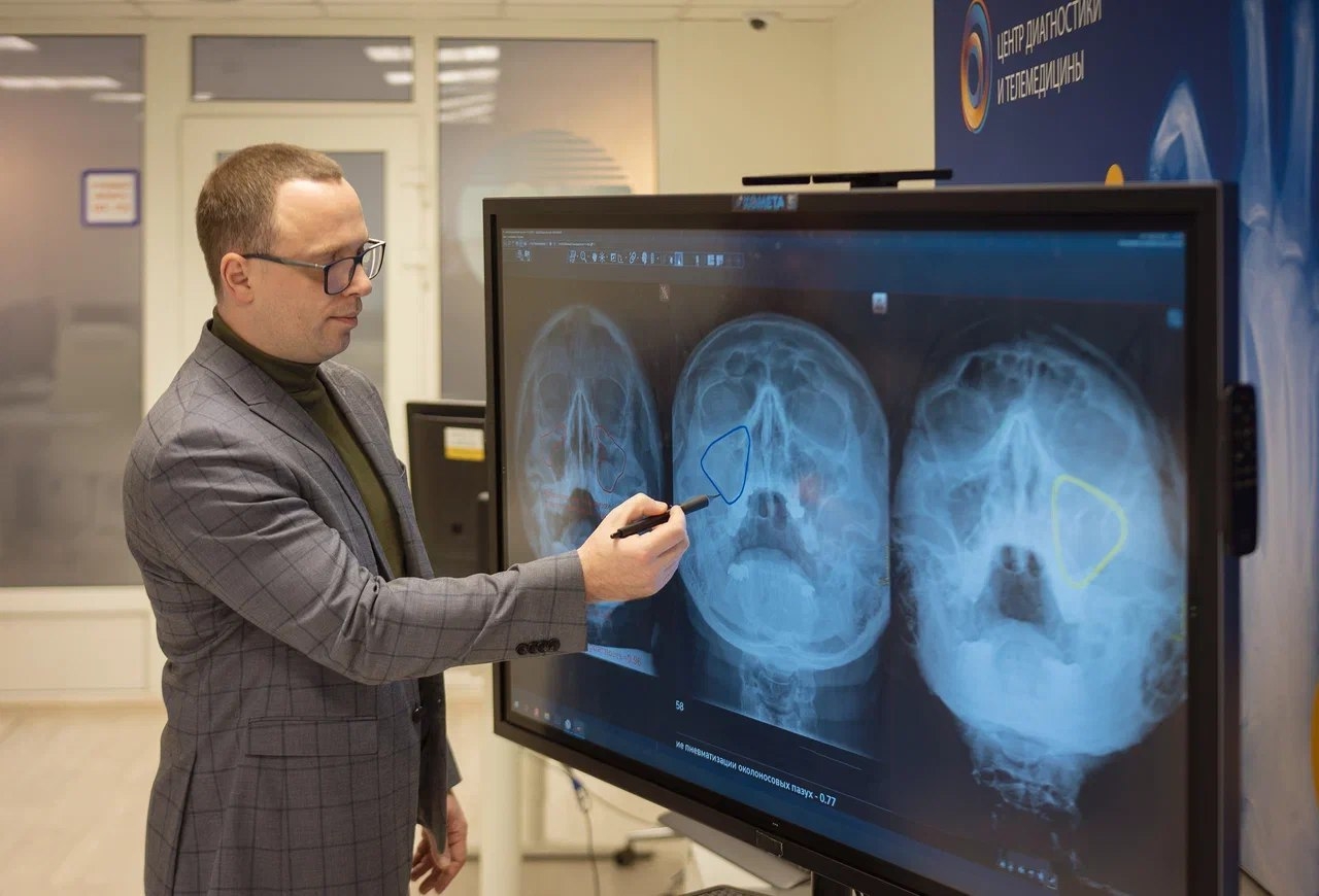 В Москве искусственный интеллект начал выявлять ЛОР-заболевания на рентгене